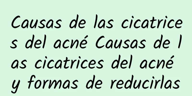 Causas de las cicatrices del acné Causas de las cicatrices del acné y formas de reducirlas