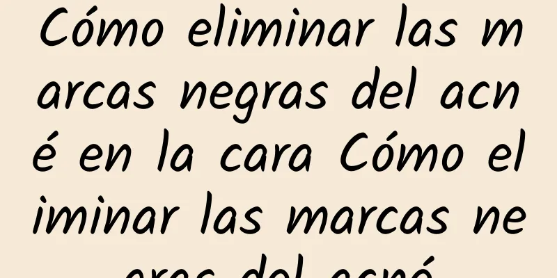 Cómo eliminar las marcas negras del acné en la cara Cómo eliminar las marcas negras del acné