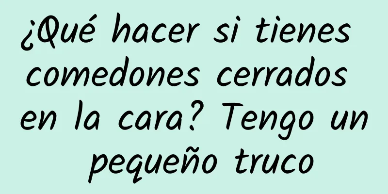 ¿Qué hacer si tienes comedones cerrados en la cara? Tengo un pequeño truco