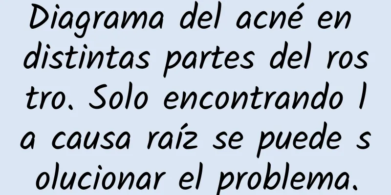 Diagrama del acné en distintas partes del rostro. Solo encontrando la causa raíz se puede solucionar el problema.
