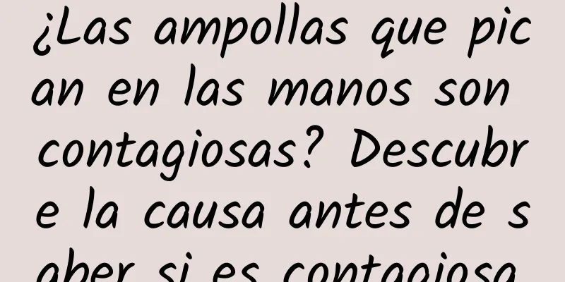 ¿Las ampollas que pican en las manos son contagiosas? Descubre la causa antes de saber si es contagiosa.