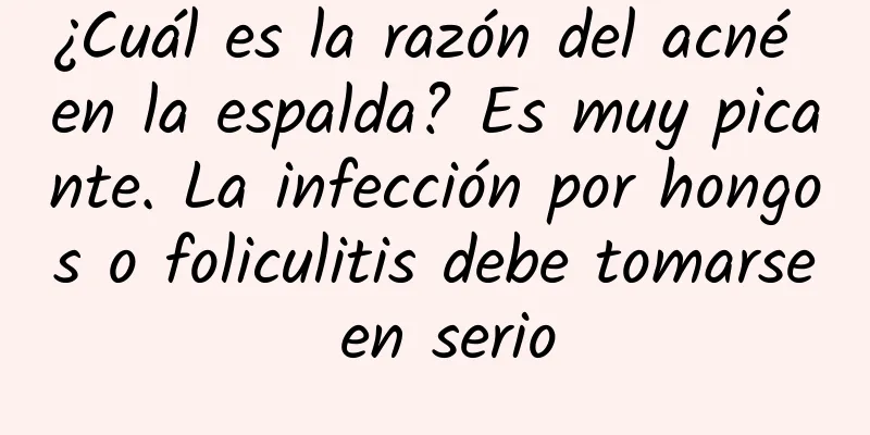 ¿Cuál es la razón del acné en la espalda? Es muy picante. La infección por hongos o foliculitis debe tomarse en serio