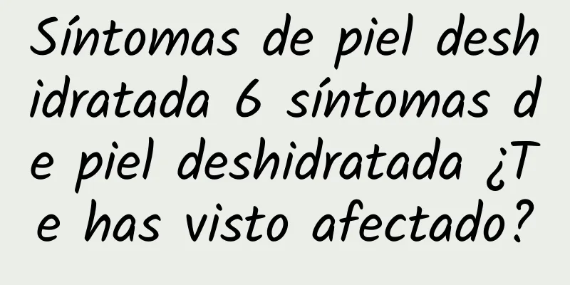 Síntomas de piel deshidratada 6 síntomas de piel deshidratada ¿Te has visto afectado?