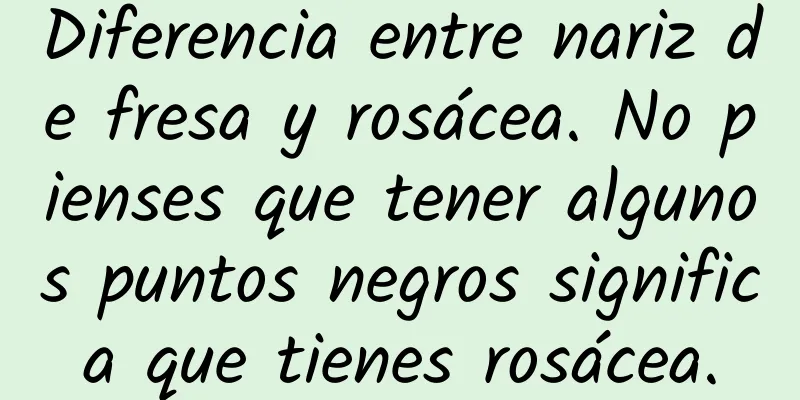 Diferencia entre nariz de fresa y rosácea. No pienses que tener algunos puntos negros significa que tienes rosácea.