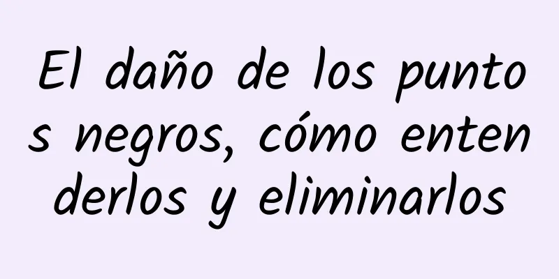 El daño de los puntos negros, cómo entenderlos y eliminarlos