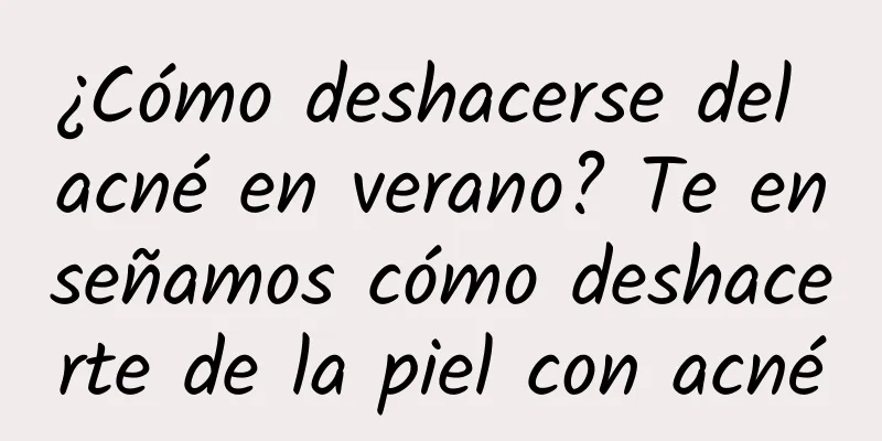 ¿Cómo deshacerse del acné en verano? Te enseñamos cómo deshacerte de la piel con acné