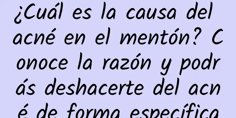 ¿Cuál es la causa del acné en el mentón? Conoce la razón y podrás deshacerte del acné de forma específica